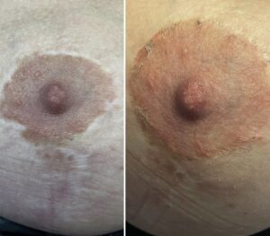 Tepelhofreconnstructie